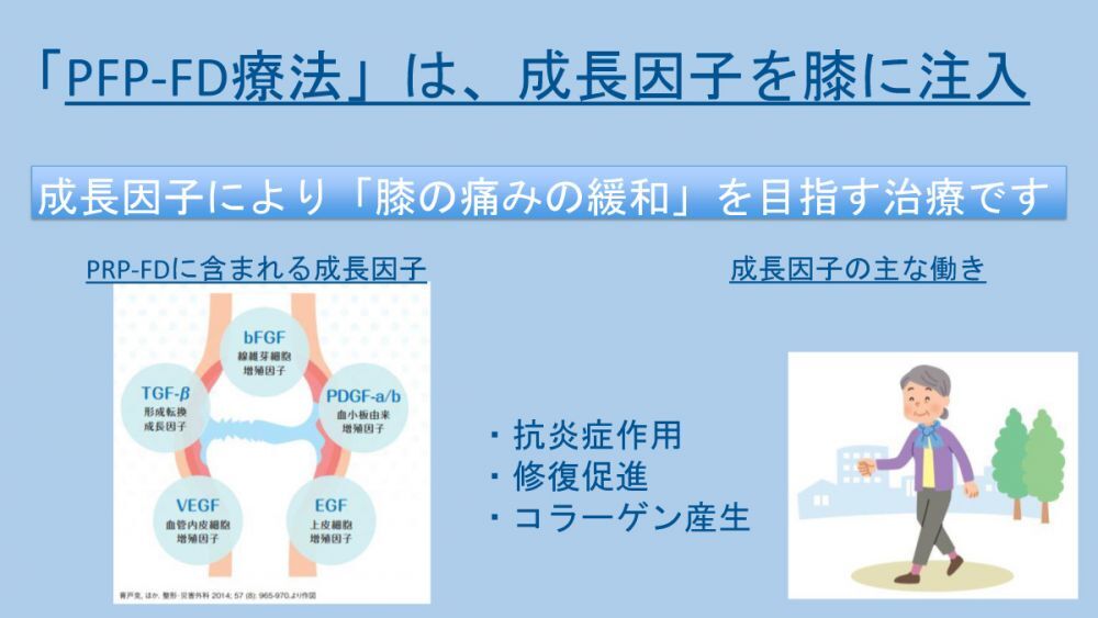 PRP-FDについて