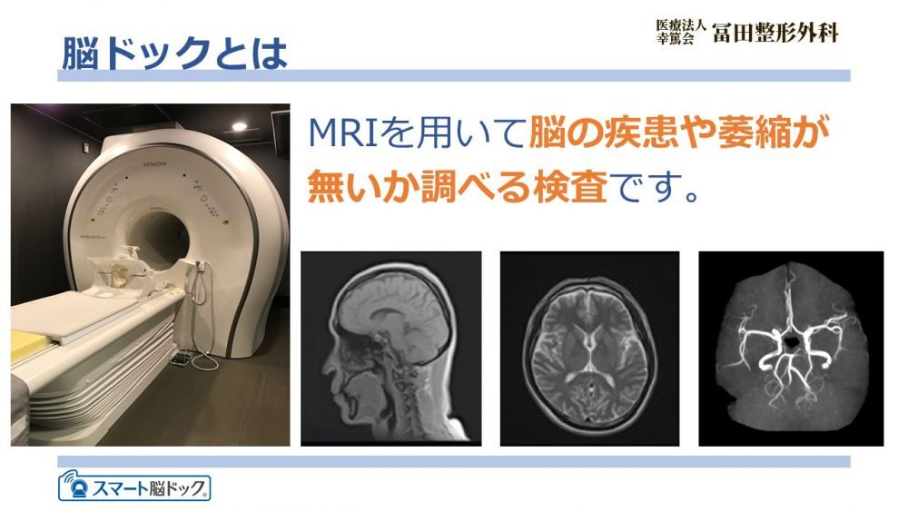 脳ドックについて