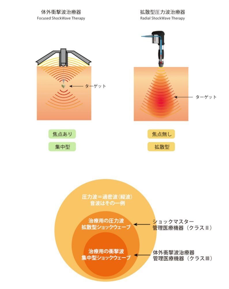 機器について