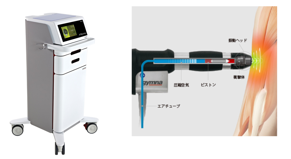 （拡散型圧力波治療機）ショックマスター